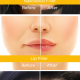 Botox fillers before after digital
