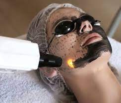 Carbon laser digital