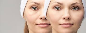 antiaging digital image