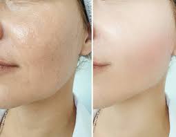 skin treatment digital