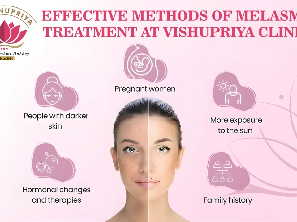Melasma-treatment