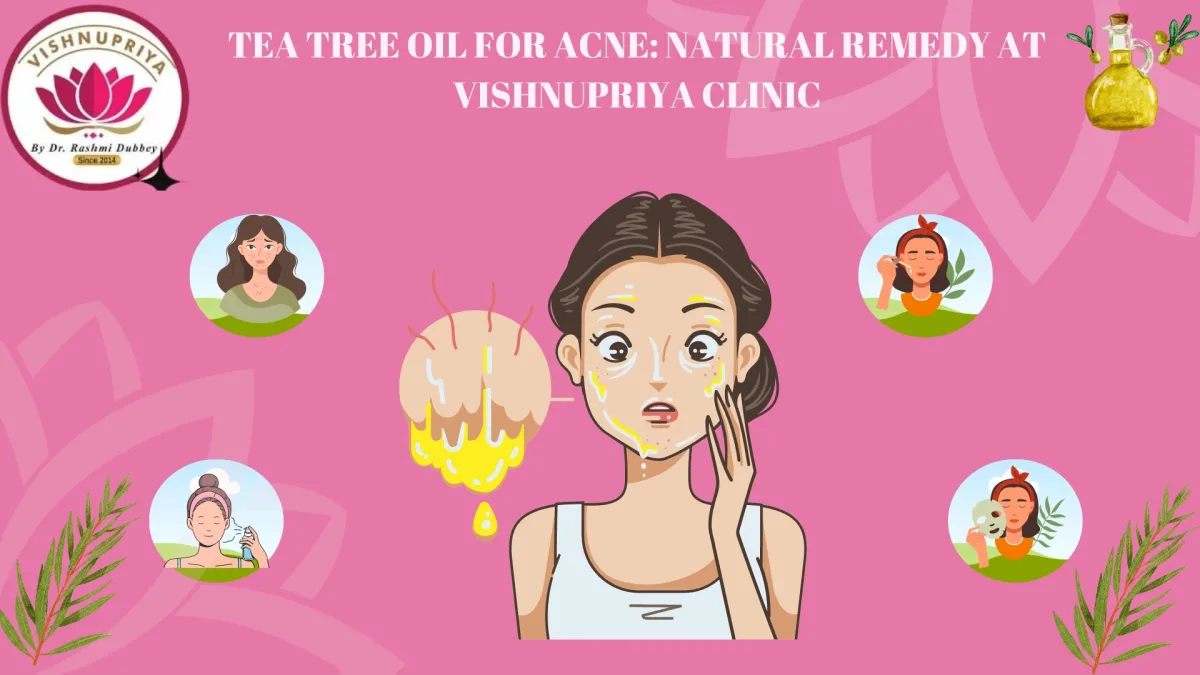 Tea Tree Oil for Acne