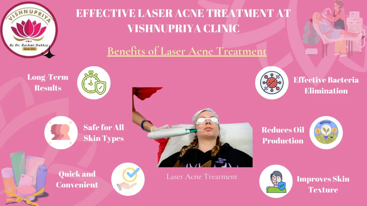 Laser Acne Treatment