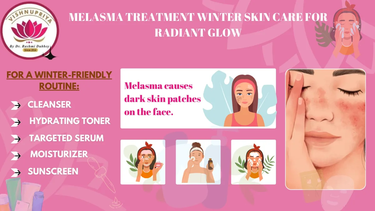 Melasma Treatment