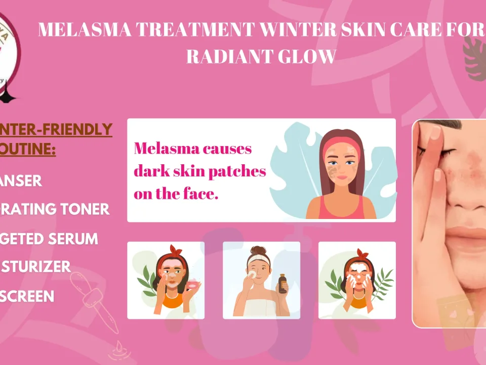 Melasma Treatment