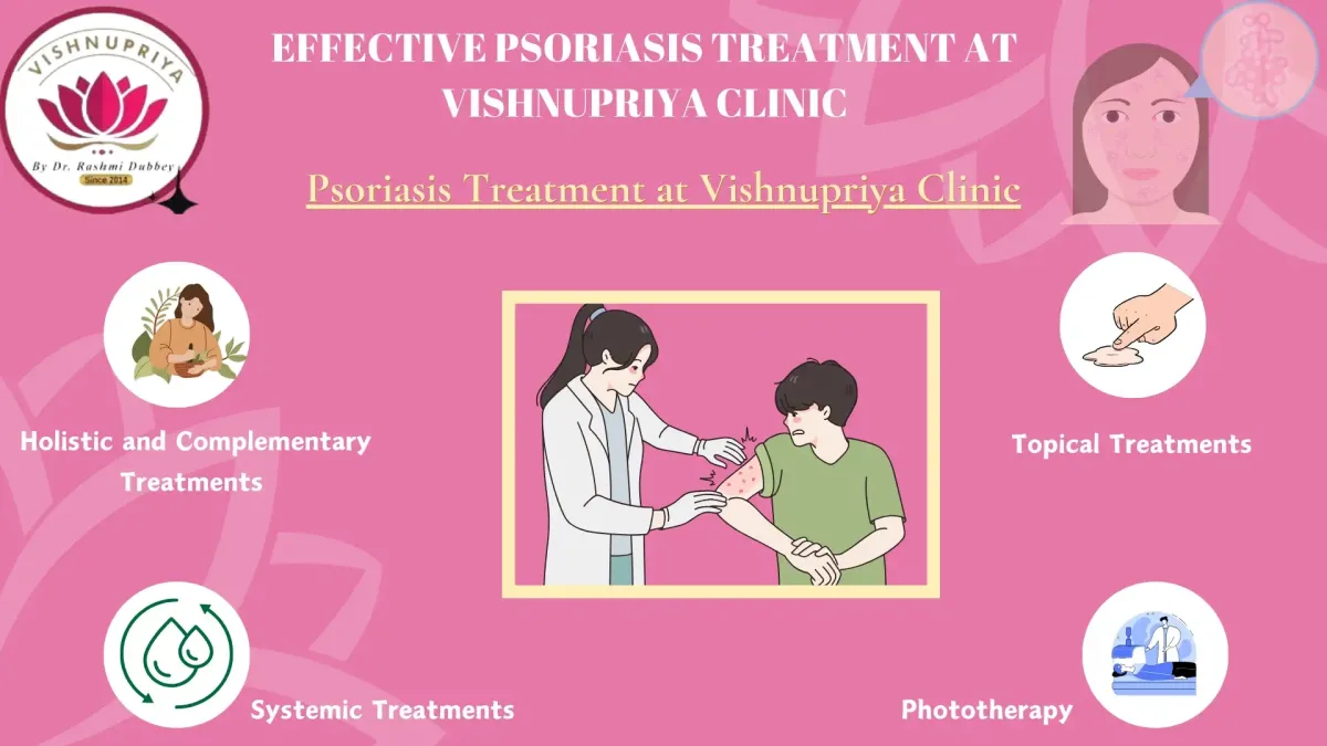 Psoriasis Treatment